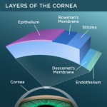 cornea-layers-325x325